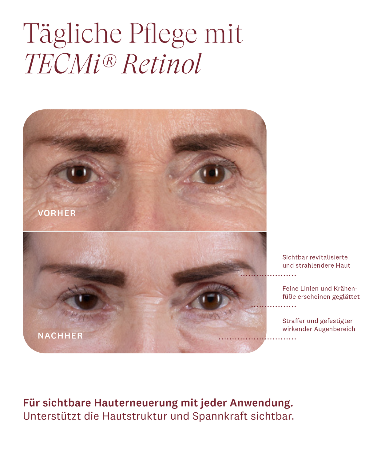 Correcting Eye Cream