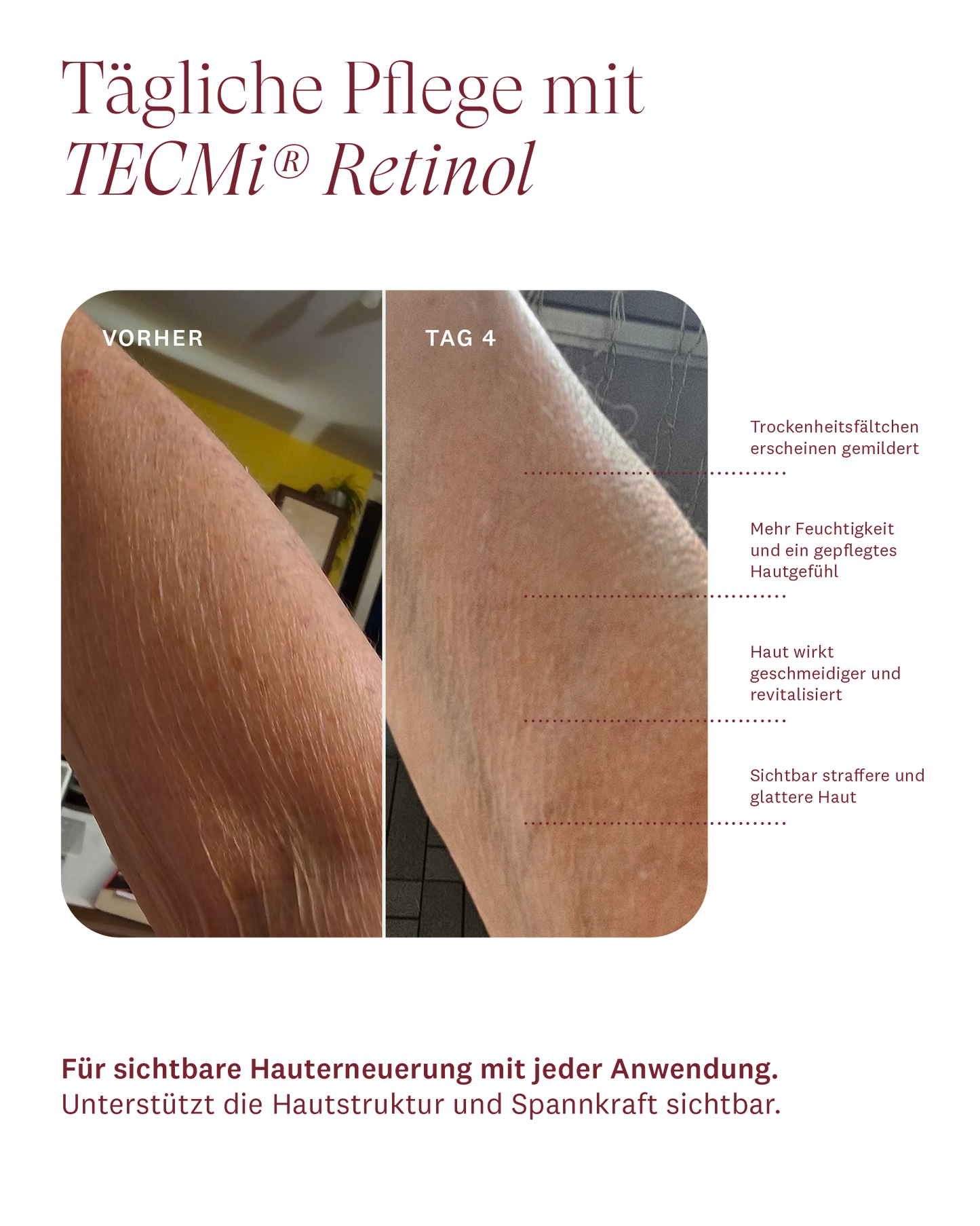 FIRMING BODY TREATMENT