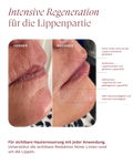 Plumping Lip Care