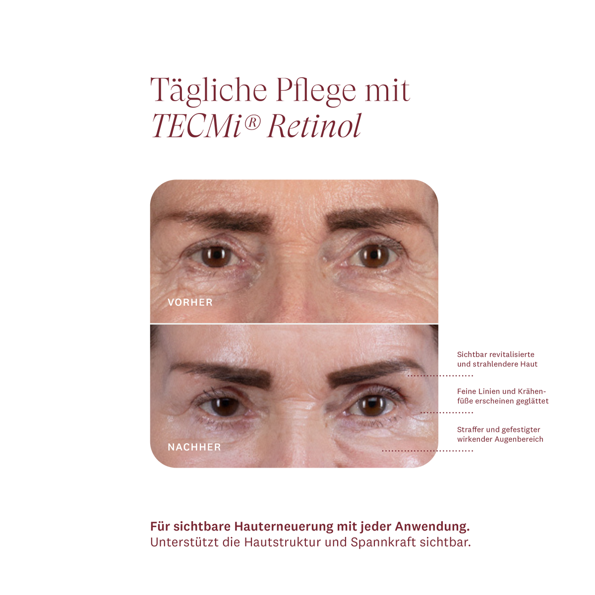 CORRECTING EYE CREAM