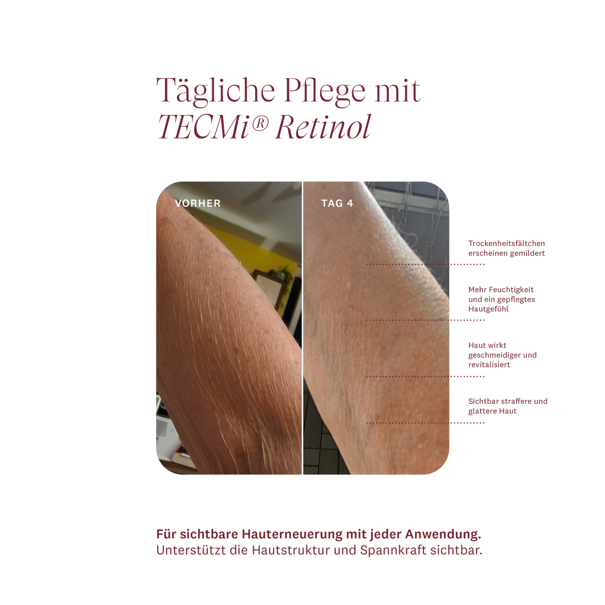 FIRMING BODY TREATMENT