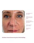 Daily 24h Retinol Routine Day & Night