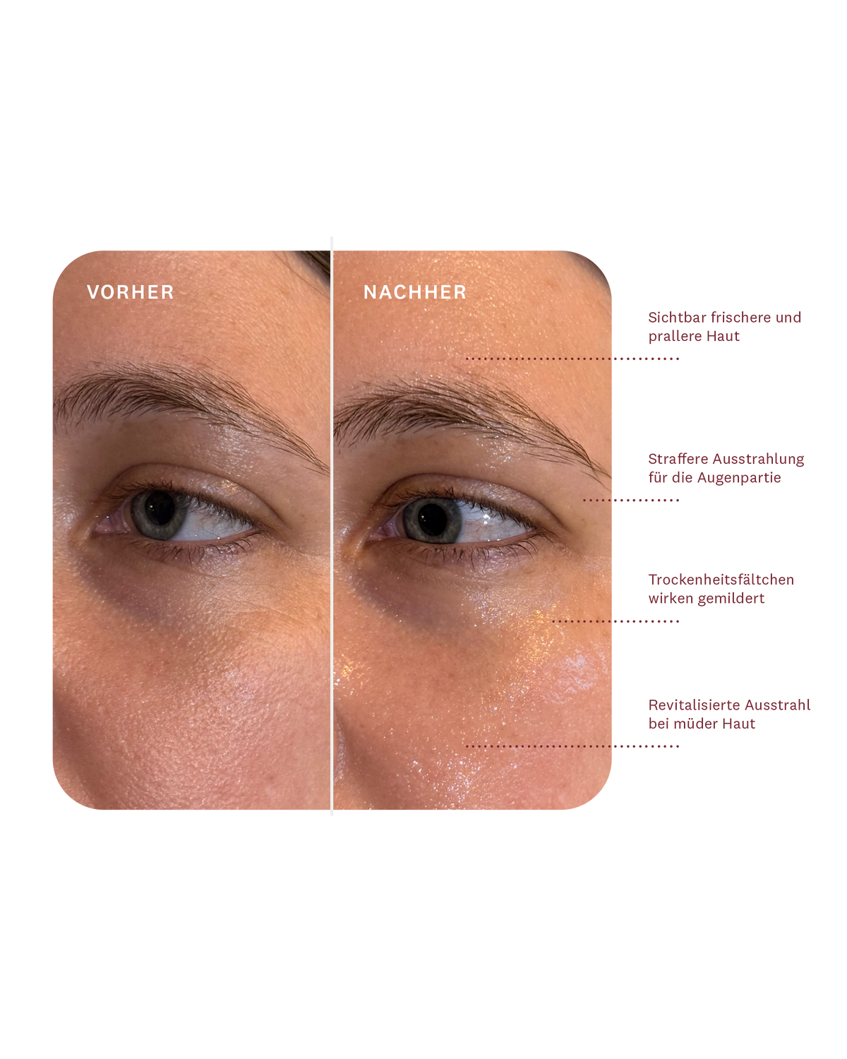 The Lift Activator Ampoule